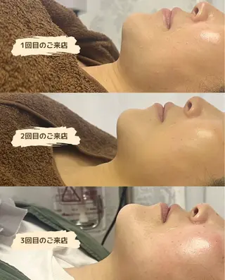 看護師が施術する美容 ナスサロ/川口のエステ・リラクイメージ