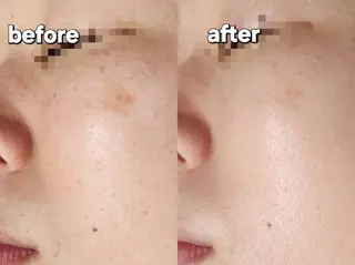 Shiny ✧︎*。のエステ・リラクイメージ