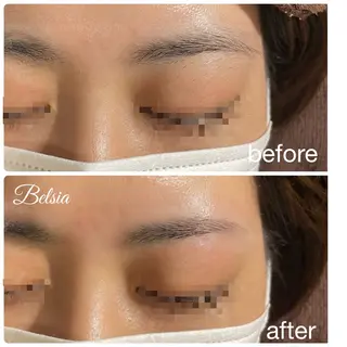 アイブロウ Belsia千歳烏山 ピーリング＆眉毛のエステ・リラクイメージ