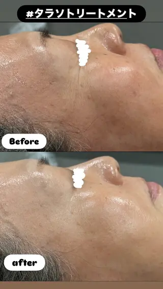 LiZA エステティックサロンのエステ・リラクイメージ