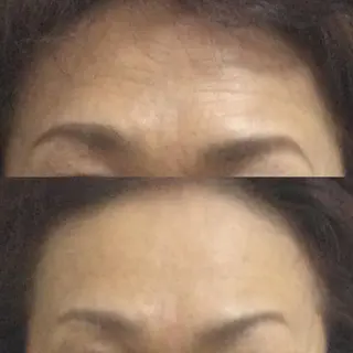 MAREA 小顔SALONのエステ・リラクイメージ