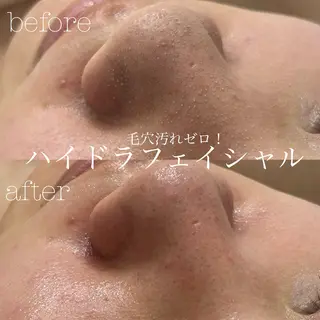 フェイシャルサロン CHIARA 荒田のエステ・リラクイメージ