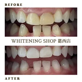 メンズ ホワイトニング ショップ葛西店のその他イメージ