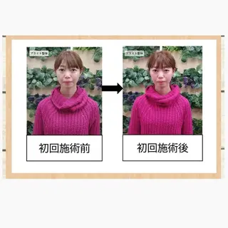 小顔矯正 頭痛専門のブライト整体 所属・ブライト整体🟠 肩こり•腰痛•首こりのエステ・リラクイメージ