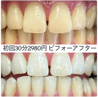 ホワイトニングルーム 横浜店のその他イメージ
