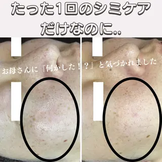 最新シミケアLily de pearlのエステ・リラクイメージ