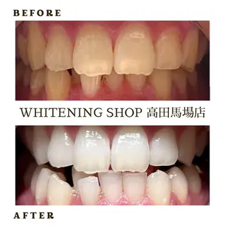 メンズ ホワイトニング ショップ高田馬場店のその他イメージ