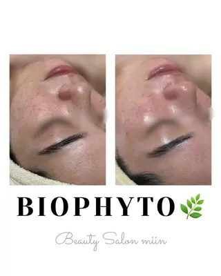 韓国肌管理 白玉肌管理®︎のエステ・リラクイメージ