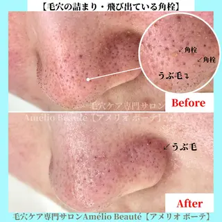 毛穴ケア専門サロン アメリオボーテのその他イメージ