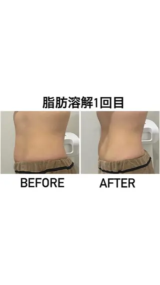 アルカンジュ~archange~所属・痩身/毛穴洗浄/脱毛 アルカンジュのエステ・リラクイメージ