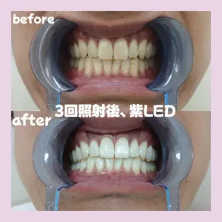 セルフホワイトニングサロンPalet【パレ】所属・太田 菜那のその他イメージ