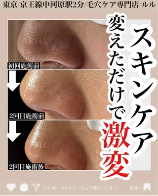 LULU ルルのエステ・リラクイメージ