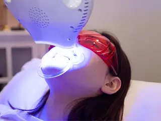 écrusmile ホワイトニングサロンのその他イメージ