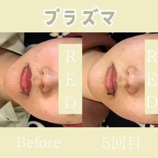 池田 桃花のエステ・リラクイメージ