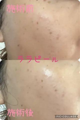 y.laBelle 艶肌・小顔・肌質改善のエステ・リラクイメージ