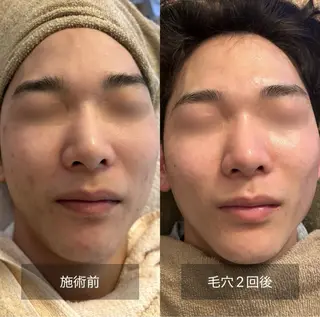 メンズ GREEN LIGHTS所属・GREEN LIGHTSのエステ・リラクイメージ