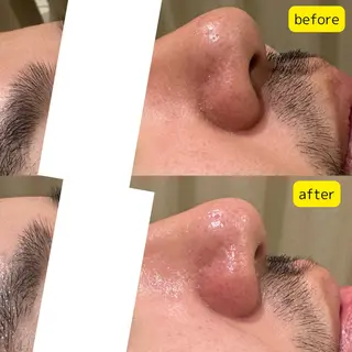 メンズ pansy フェイシャルエステのエステ・リラクイメージ