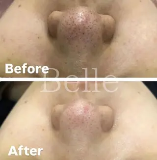 佐藤 加奈のエステ・リラクイメージ