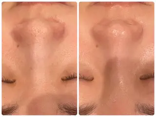 レイビス名古屋♡ 川北♡U24のエステ・リラクイメージ