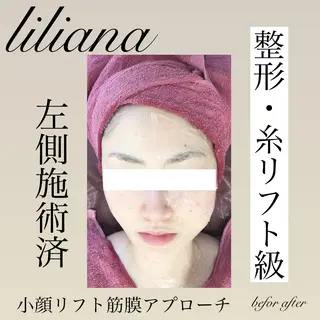 LILIANA ☆YURIのエステ・リラクイメージ