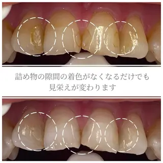歯科医院提携 Retreatのエステ・リラクイメージ