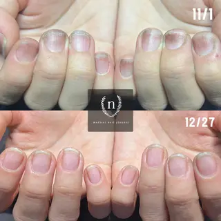 ネイル 自爪育成専門サロン ◌𓈒azumiのネイルデザイン