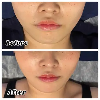 🌴Beauty Salon LANAのエステ・リラクイメージ