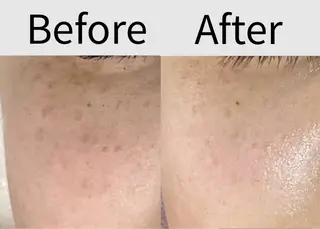 都度払い 肌質改善専門サロンのエステ・リラクイメージ