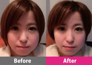 【顔面整体 アルソワート】のエステ・リラクイメージ