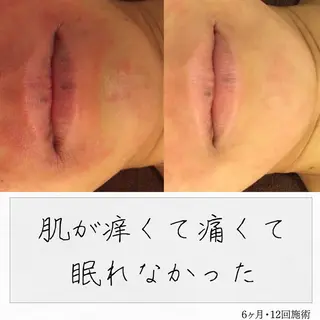 ニキビ経験者が施術 する専門サロン🌻のエステ・リラクイメージ