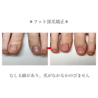 ネイル ネイルサロン アリュームのネイルデザイン