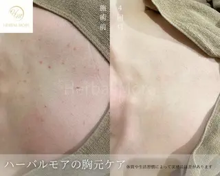 脱毛・眉毛・フェイス サロンN久留米店の眉毛・アイブロウイメージ