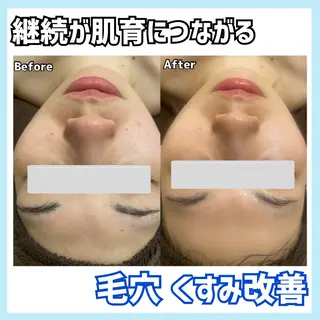 オールハンド専門🤍 痩身/小顔/ ハーブのエステ・リラクイメージ