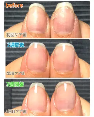 ネイル 自爪育成ネイルサロン Pause(ポーズ)のネイルデザイン