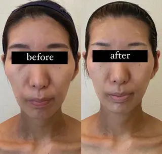 整形級の変化👀 最新✨韓国小顔管理のエステ・リラクイメージ