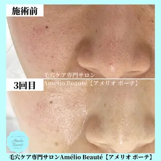 毛穴ケア専門サロン アメリオボーテのその他イメージ