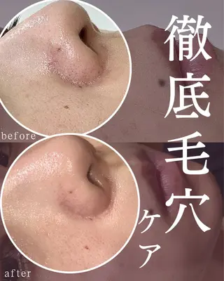 POLA THE BEAUTY イオンタウン各務原鵜沼所属・POLA各務原鵜沼店 伊佐次のエステ・リラクイメージ