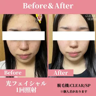 有人型セルフサロン 脱毛/痩身/美顔のエステ・リラクイメージ