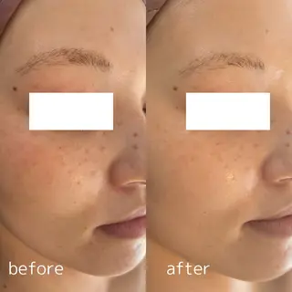 Le cherienのエステ・リラクイメージ