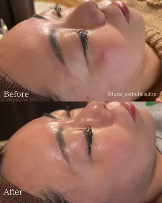 Luca所属・Luca 痩身• 疲労改善×韓国肌管理のエステ・リラクイメージ