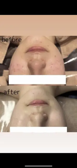 🗻エステティック RAYVIS藤🐈のエステ・リラクイメージ