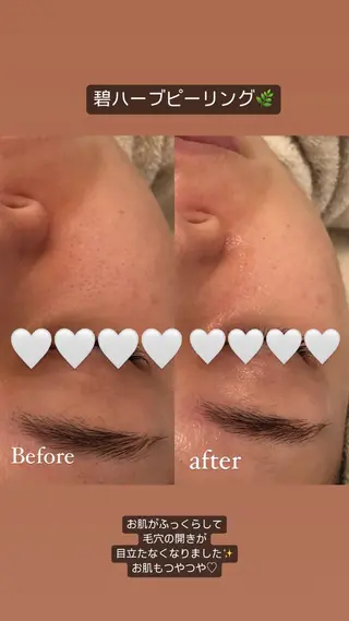 MORE. NEMAのエステ・リラクイメージ