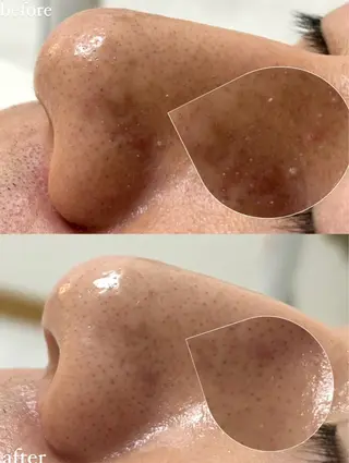 女性専門お顔剃り sunraineのエステ・リラクイメージ