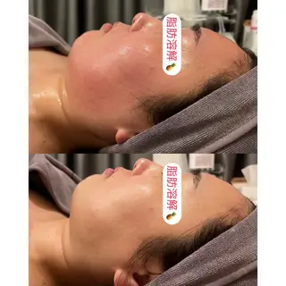 小顔コルギ ☆表参道/外苑前のエステ・リラクイメージ