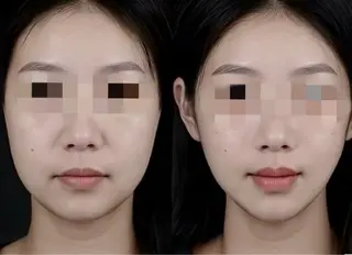 アイブロウ aliaハーブ水光店 エステティシャン募集のエステ・リラクイメージ