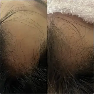 アロマ･美容鍼･カッ ピング「麗」鍼灸院のエステ・リラクイメージ