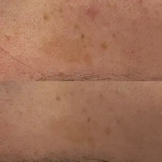 べアール所属・小顔/毛穴/ニキビ salon bealのエステ・リラクイメージ