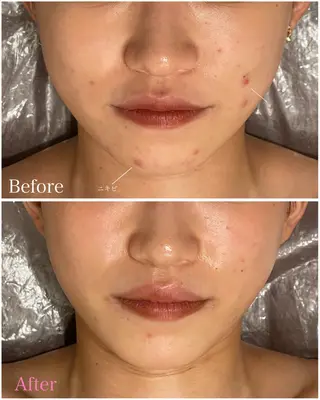 中尾 朱里のエステ・リラクイメージ