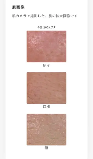 POLAクリスタルアンジュ所属・POLA御器所店 かわいれなのエステ・リラクイメージ