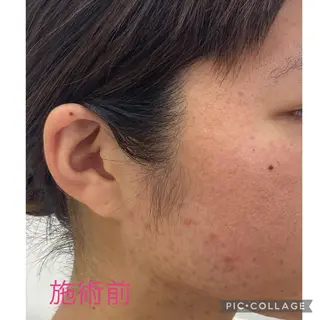 ノエビア ラボーテサロンのエステ・リラクイメージ